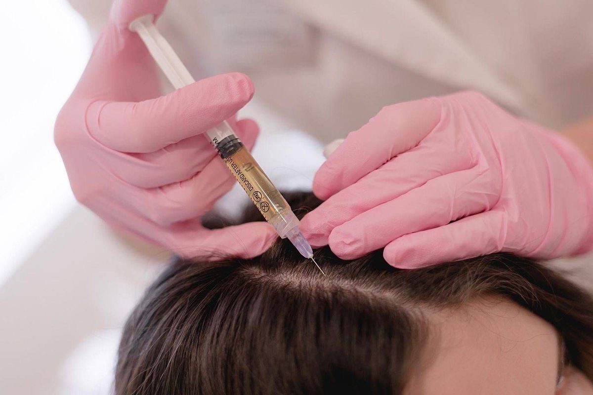 PRP injection procedure